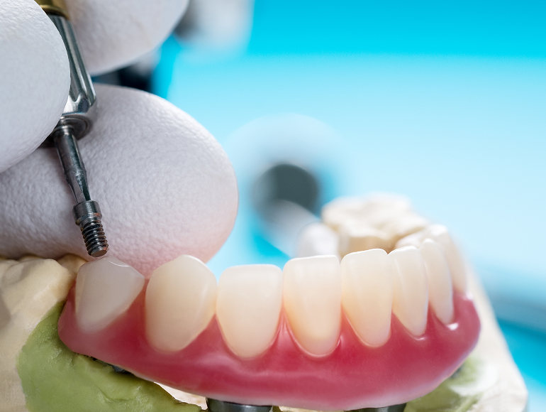 Denture care, relines and repairs in Tuscaloosa, AL