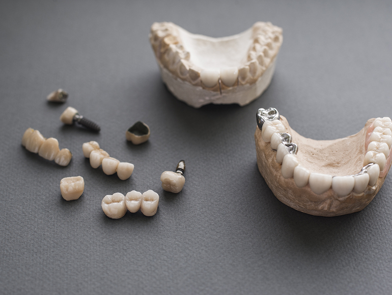 Denture options in Tuscaloosa, AL