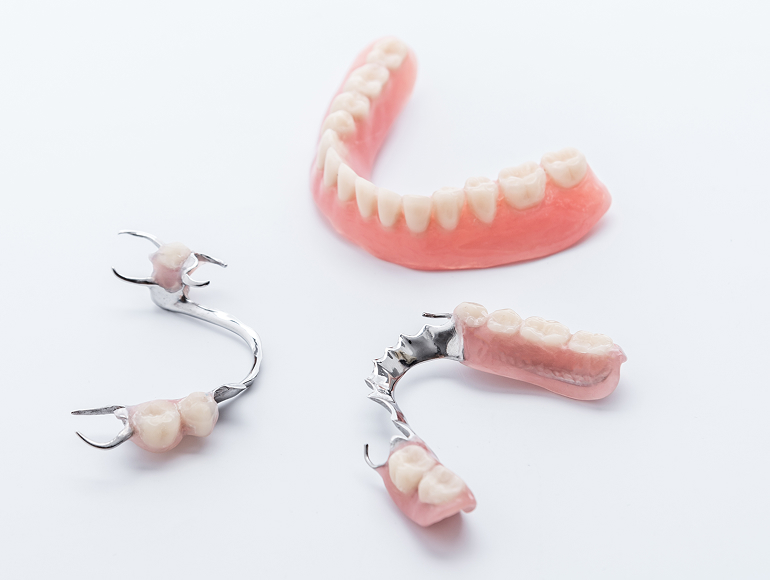 Partial denture consultation in Tuscaloosa, AL