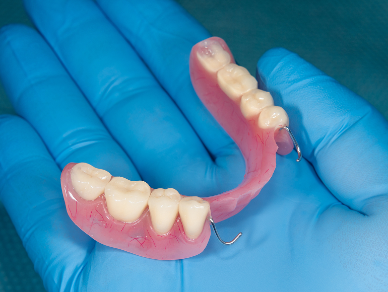 Caring for partial dentures in Tuscaloosa, AL